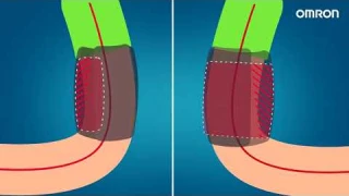 Манжета OMRON Intelli Wrap - точное измерение артериального давления