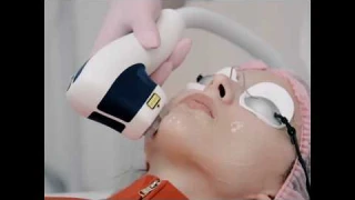 Лазерное омоложение лица