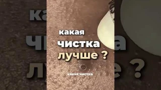 Какая чистка кожи лучше ? Вакуум ,ультразвук , механическая ,гайд по уходу в лс#кожа #уходзакожей