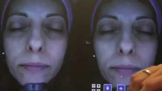 Dermacheck – косметологический аппарат для диагностики кожи лица
