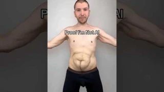 How Much Loose Skin Do I Have?