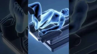 3D Animation of Hemorrhoidoplasty Procedure. #shorts
