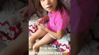 АУТИСТ 🙏Всю ночь разгрызала руку😫НОЧЬ БЕЗ СНА😱